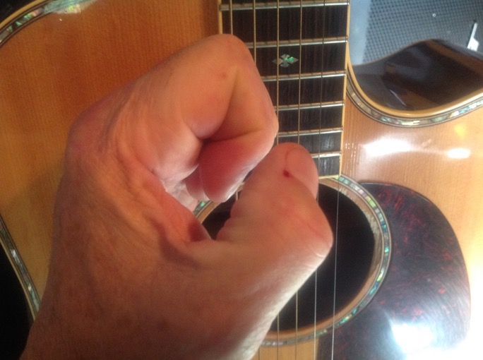 J. Brian fingers healed